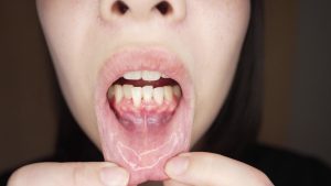 Thumbnail of post image 119